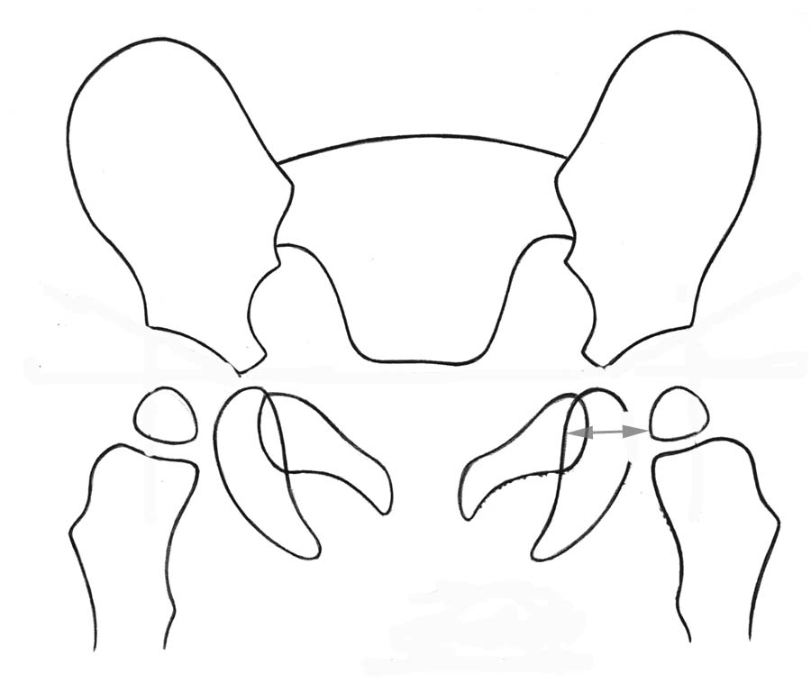 Pediatric Radiology Normal Measurements OHSU